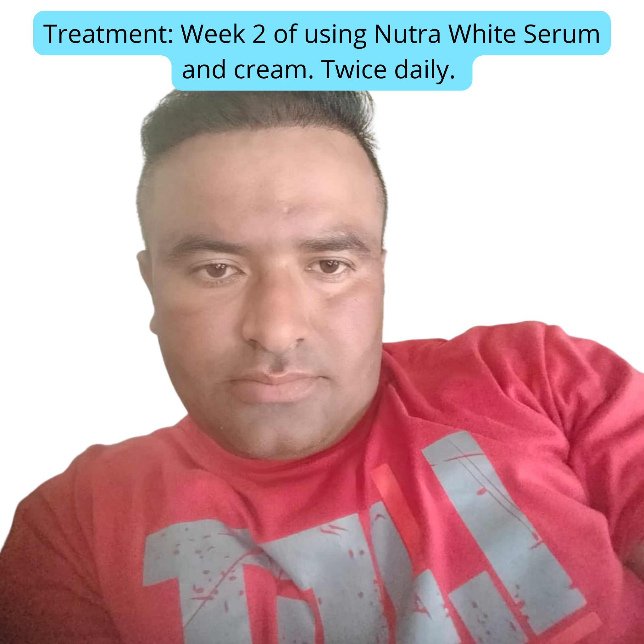 Nutra White Glutathione Whitening Serum